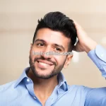 کاشت مو و ابرو روی ناحیه ریزش سکه ای در تهران