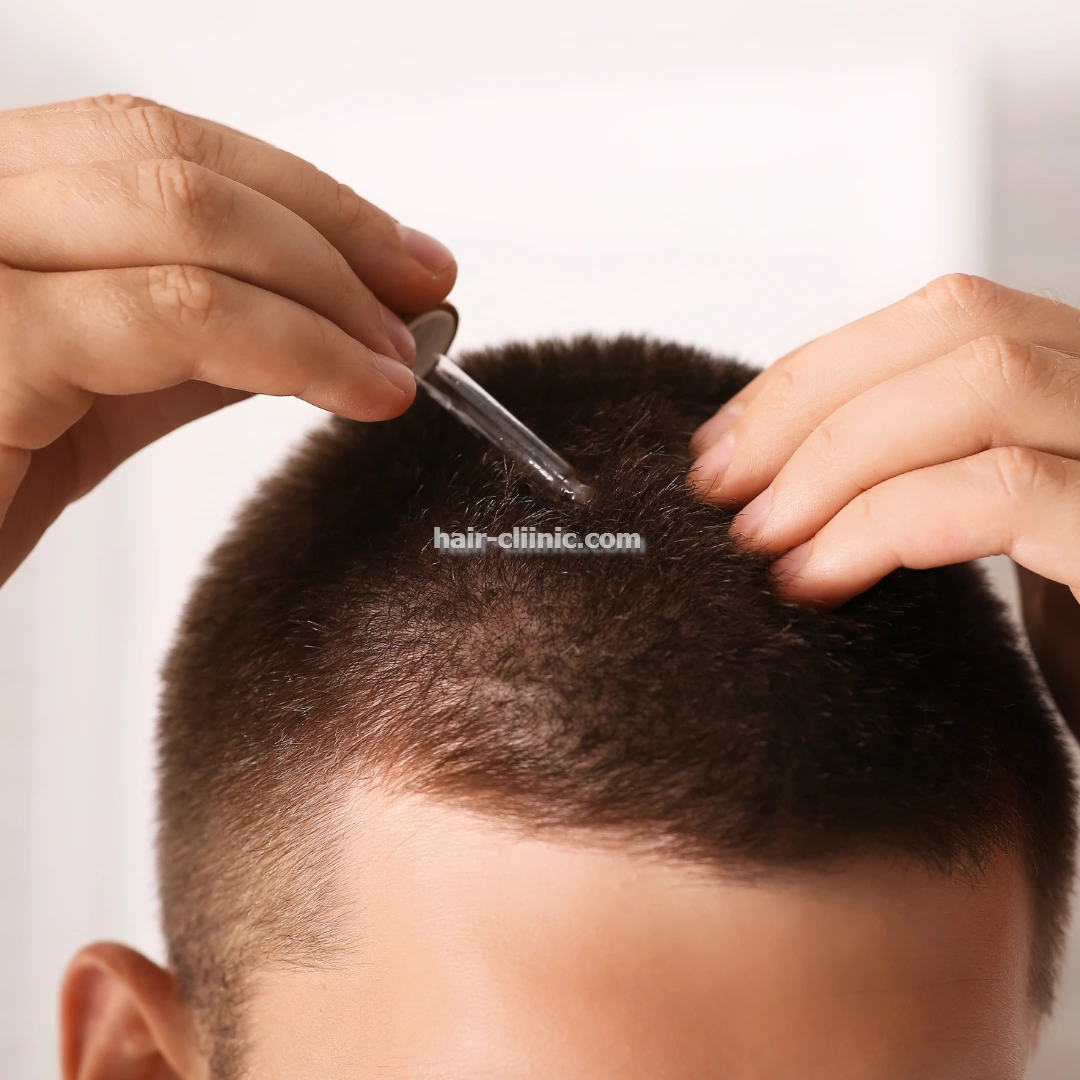 خدمات کاشت مو و ابرو FUT در تهران