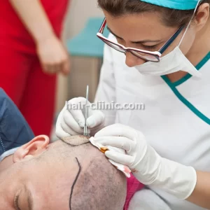 کاشت مو و ابرو برای اصلاح خط رویش در تهران